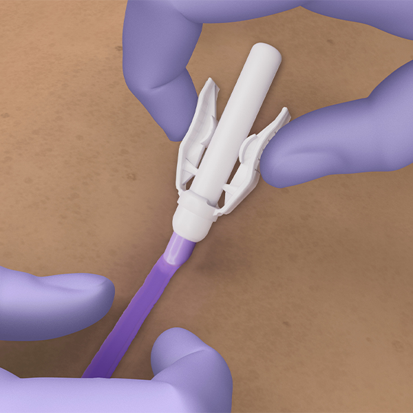 Octyl application - slide 3